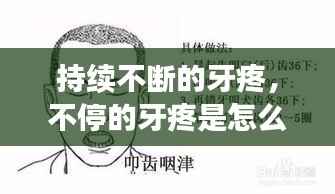 持续不断的牙疼，不停的牙疼是怎么了? 
