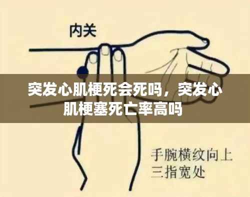 突发心肌梗死会死吗,突发心肌梗塞死亡率高吗