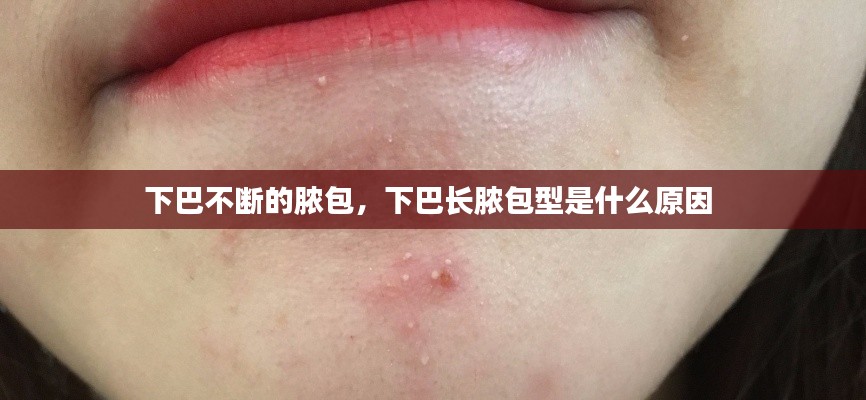 下巴不断的脓包,下巴长脓包型是什么原因
