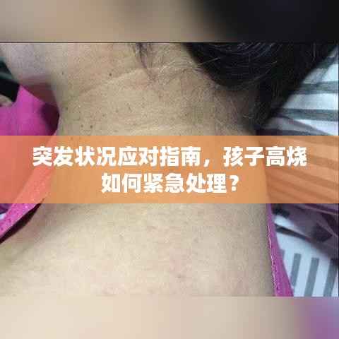 突发状况应对指南,孩子高烧如何紧急处理?